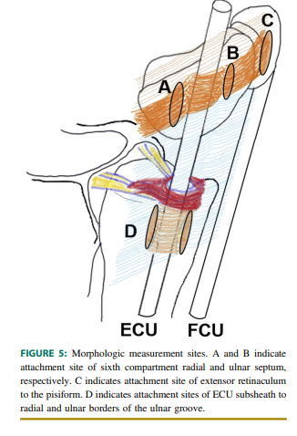 TFCC 통증? 손목 척측수근신근 건초염을 함께 치료해야 합니다 <초음파 약침>