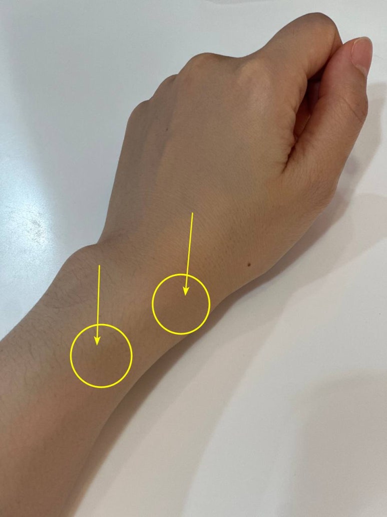 만성 손목 통증, 건초염 증상 치료 주사 <이것>이 원인?