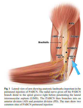 팔꿈치 바깥쪽 통증, 테니스 엘보 염증이 아닌 <이것>일 수 있습니다