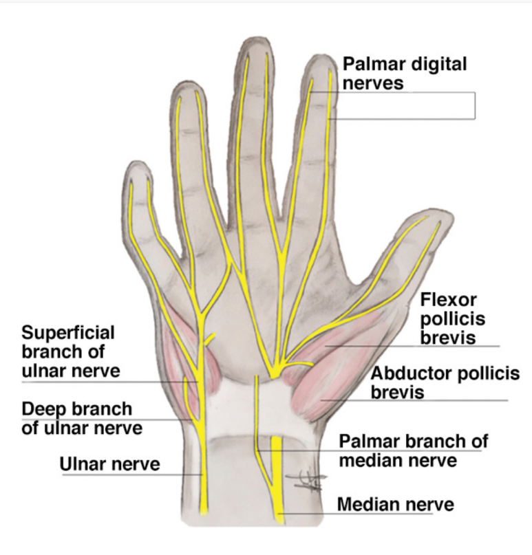 손목터널증후군 손저림? 섬유화 유착을 해결해야 합니다. <초음파 약침>