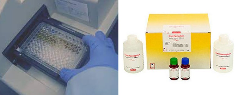 월경과다의 진단, 월경량의 객관적인 측정이 중요합니다