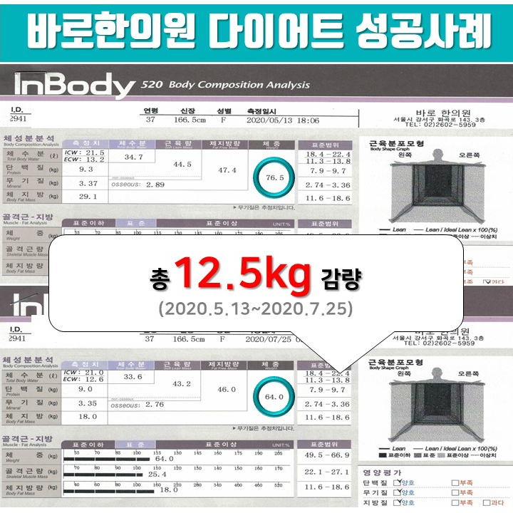 30대 여성 -12.5kg 한약 다이어트 성공[화곡역 다이어트 한의원]