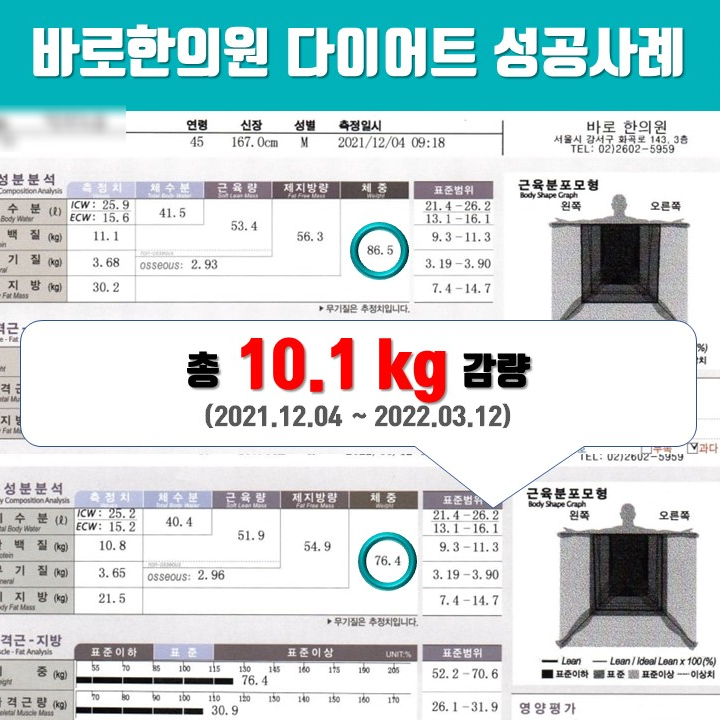40대 남성 -10.1kg 감량, 3개월 한약 다이어트 후기 [화곡역 다이어트]