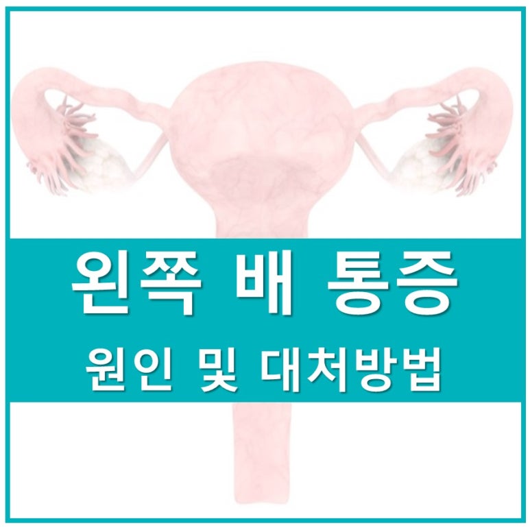 여자 왼쪽 배 통증, 제대로 알고 대처하자!