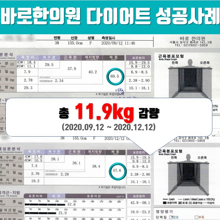 30대 여성 -11.9kg 감량, 출산후 한약다이어트 성공 [화곡역 한의원]