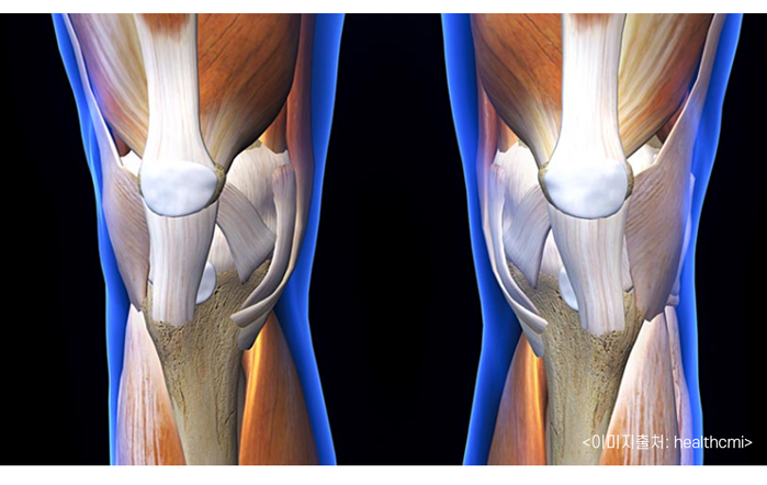 무릎 퇴행성 관절염에는 전기침이 효과적 [화곡역 추나 한의원]