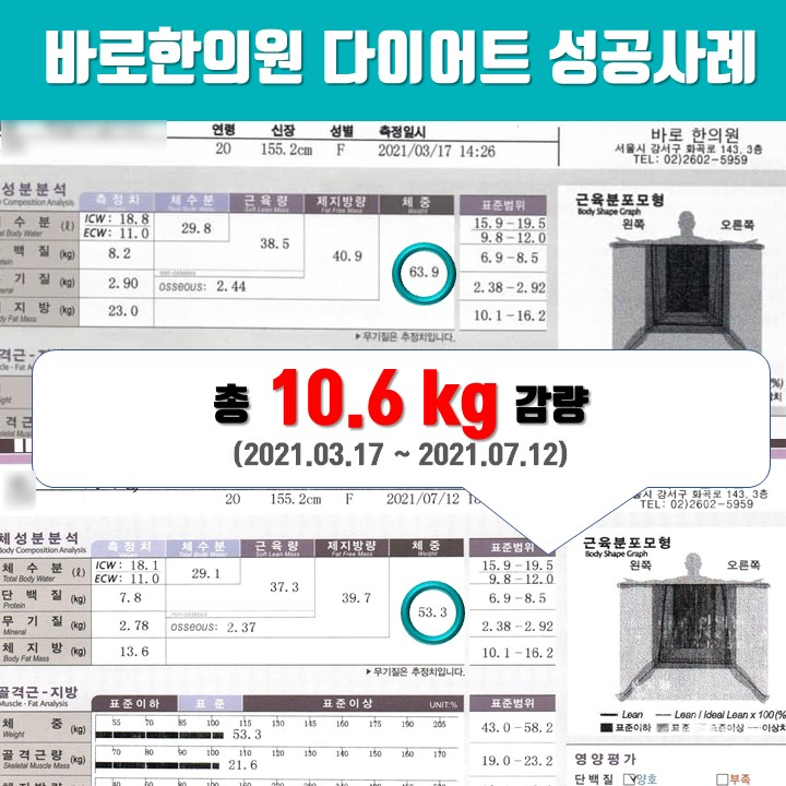 20대 여성 3개월간 -10.6kg 감량 성공! [한약 다이어트 후기]