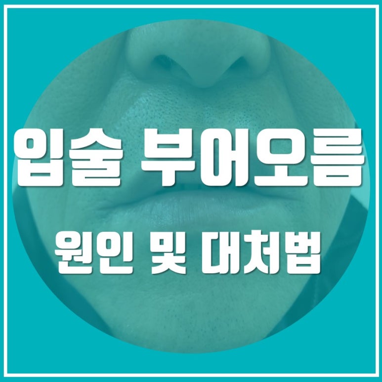 갑작스런 입술 부어오름, 염증일까요?