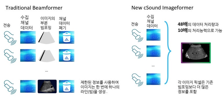 GE Fortis (E10 슬림버전), 초음파 최상위 기종