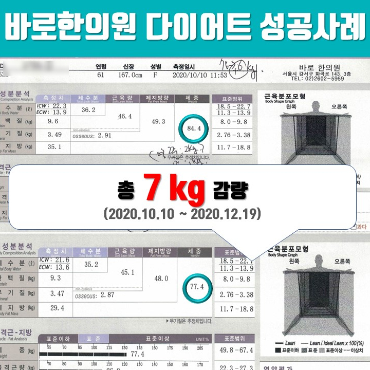 60대 여성 -7kg, 살빼고 무릎 관절염이 좋아졌어요. [한약다이어트 한의원]