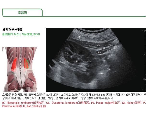 화곡동 허리 디스크 아플때, 초음파로 정확하게 치료하는 곳 있습니다