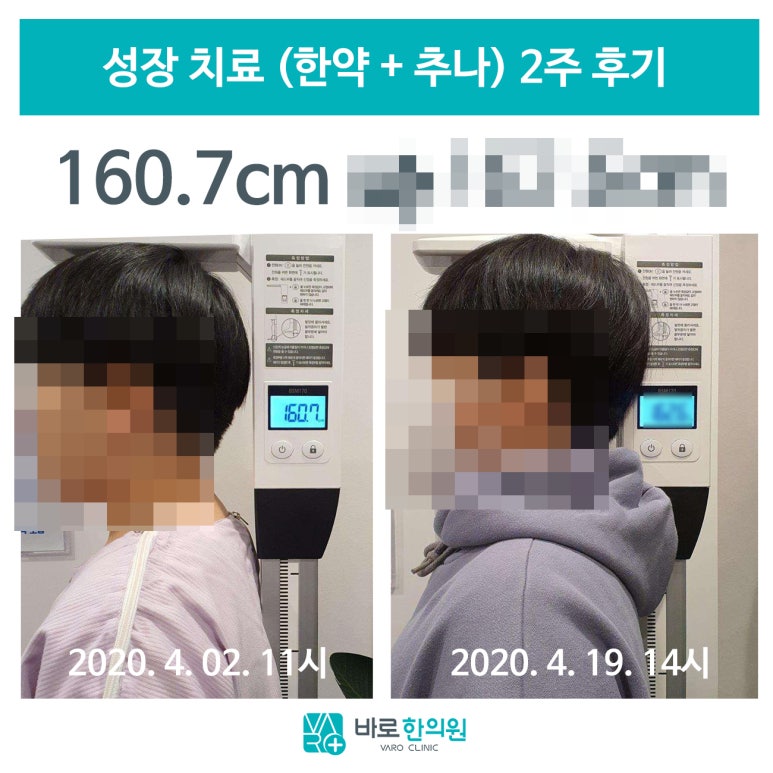 키 크는 한약 + 척추 측만증 교정하는 추나요법 [강서구 성장 한의원]