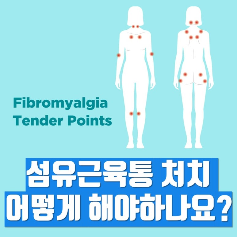진통제로 낫지 않는 섬유근육통, 신경병증성 통증 관리 어떻게?