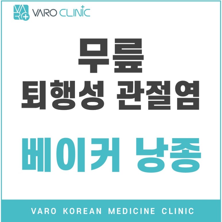 무릎 퇴행성 관절염, 베이커 낭종 치료 후기