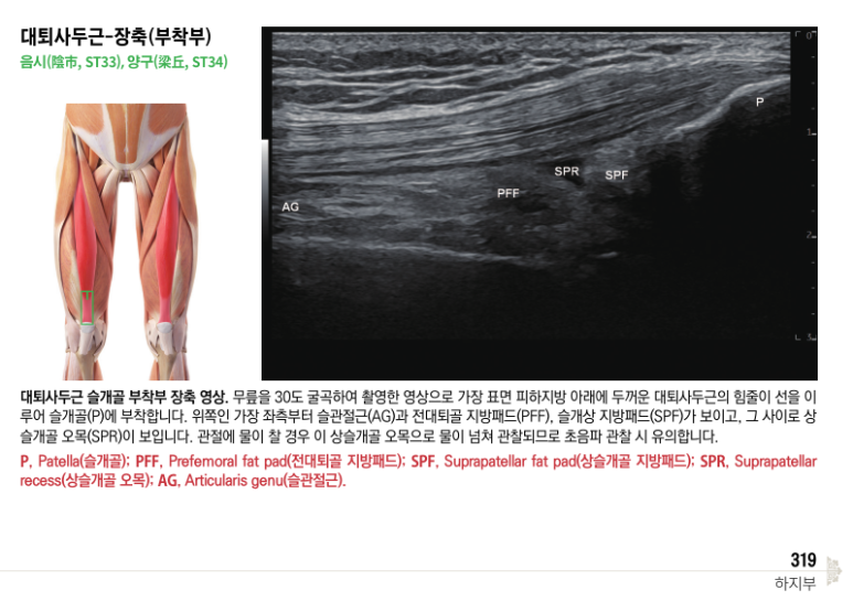 반월상 연골 파열 증상, 연골판 수술 <치료 사례들> 확인하세요!