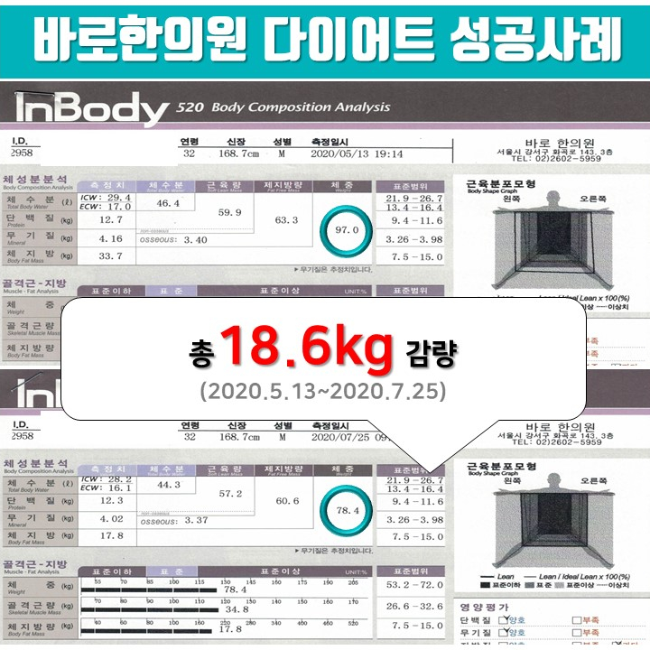 30대 남성 -18.6kg 감량, 2달 10일간 한약다이어트 [화곡역 다이어트 한의원]