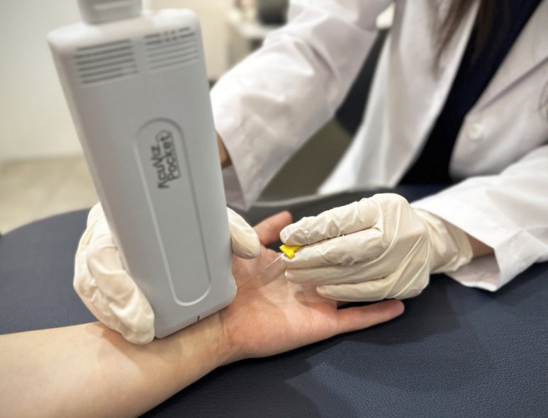 초음파 유도하 전기침, 정중신경 회복 효과 입증