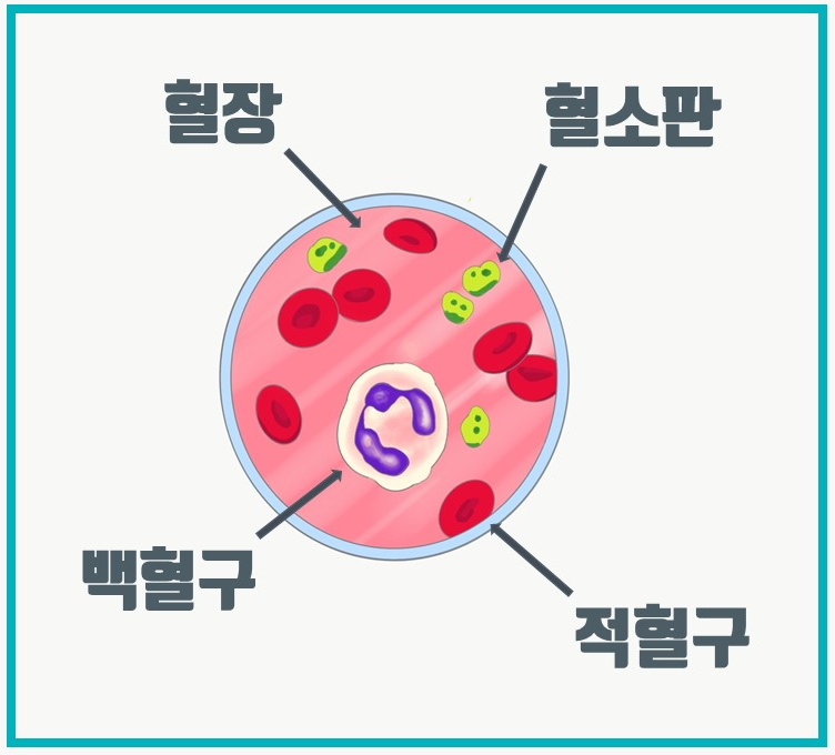 백혈구 수치 높으면 어떤 질병을 의심하나요?