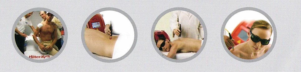 고강도 레이저 치료를 받는 다양한 환자들의 모습이 담긴 네 개의 원형 사진 — 서울 바로한의원 초음파 약침·도침