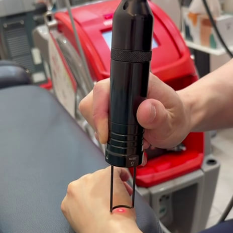 검은색 레이저 치료기로 환자의 손등에 레이저를 조사하는 모습 — 서울 바로한의원 초음파 약침·도침