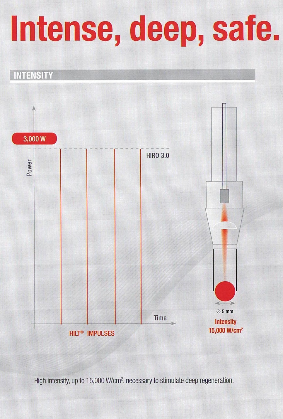 HILT 임펄스와 HIRO 3.0 레이저의 출력 및 시간 그래프와 5mm 직경, 15,000 W/cm² 강도를 나타내는 레이저 핸드피스 다이어그램 — 서울 바로한의원 초음파 약침·도침