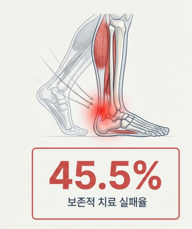 아킬레스건 부위에 통증이 있는 다리 해부도와 45.5%의 보존적 치료 실패율을 나타내는 숫자 박스 — 서울 바로한의원 초음파 약침·도침
