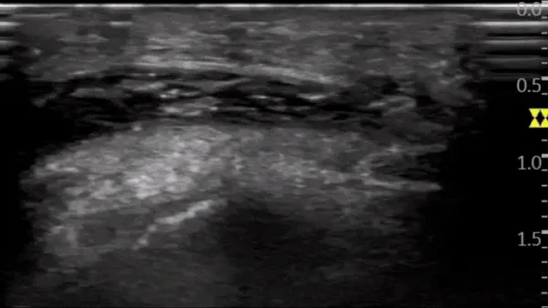 인체 내부를 보여주는 경혈 초음파 이미지 — 초음파 정밀 진단 | 서울 바로한의원 초음파 약침·도침·침도