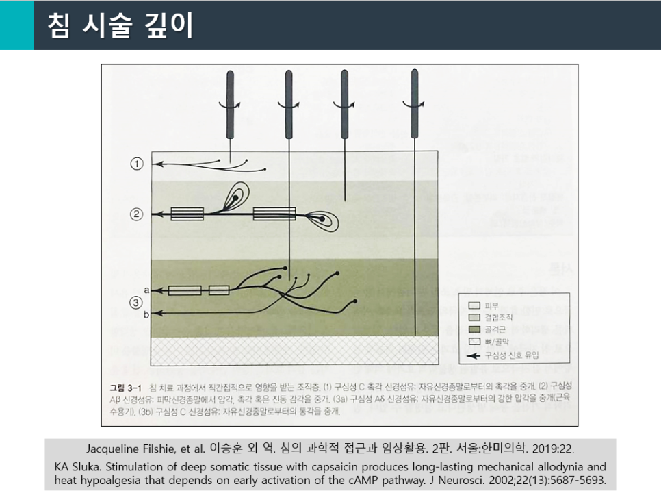 침 시술 깊이에 따른 피부, 결합조직, 골격근 등 여러 조직층과 신경 섬유의 반응을 보여주는 그림 — 초음파 유도하 약침 시술 | 서울 바로한의원