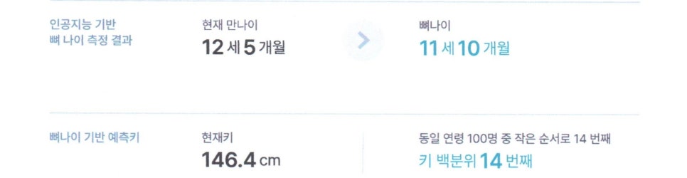 인공지능 기반 뼈 나이 측정 결과와 현재 만 나이, 뼈 나이, 현재 키, 키 백분위가 표시된 화면 — 서울 바로한의원 초음파 약침·도침