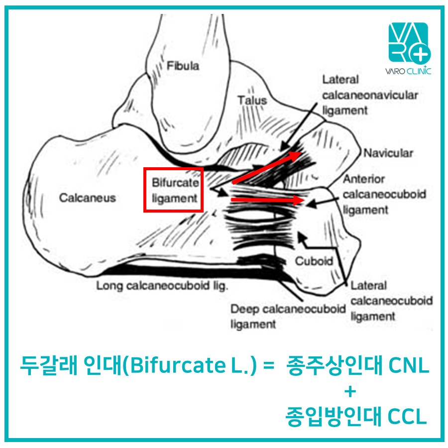발목의 두갈래 인대(Bifurcate ligament)와 주변 인대들의 해부학적 구조를 나타낸 그림 — 서울 바로한의원 초음파 약침·도침