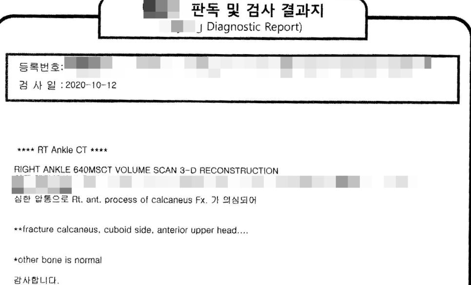 오른쪽 발목 CT 검사 결과지. 2020년 10월 12일 검사일과 발꿈치뼈 골절 소견이 기재되어 있다 — 서울 바로한의원 초음파 약침·도침