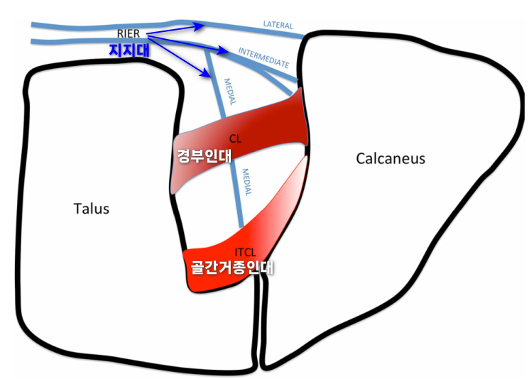 발목의 거골과 종골 사이 족근동 부위 인대 구조를 나타낸 해부학적 그림 — 서울 바로한의원 초음파 약침·도침