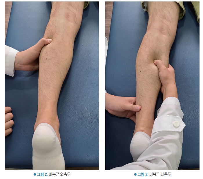 환자의 종아리 비복근 외측두와 내측두를 촉진하는 모습 — 서울 바로한의원 초음파 약침·도침