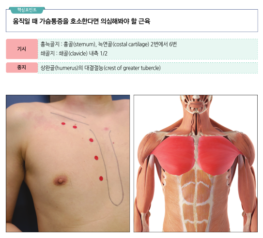 가슴에 해부학적 표시가 된 사람의 상체와 대흉근이 강조된 해부학적 그림 — 서울 바로한의원 초음파 약침·도침