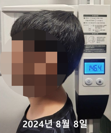키 측정 기계에 서 있는 아이의 옆모습과 146.4로 표시된 측정값 — 서울 바로한의원 초음파 약침·도침