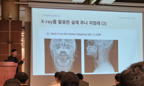 발표자가 청중 앞에서 X-ray 영상이 보이는 슬라이드를 배경으로 추나 치료 사례를 설명하고 있다 — 대한한의영상학회 초음파 약침·도침 강의 | 서울 바로한의원