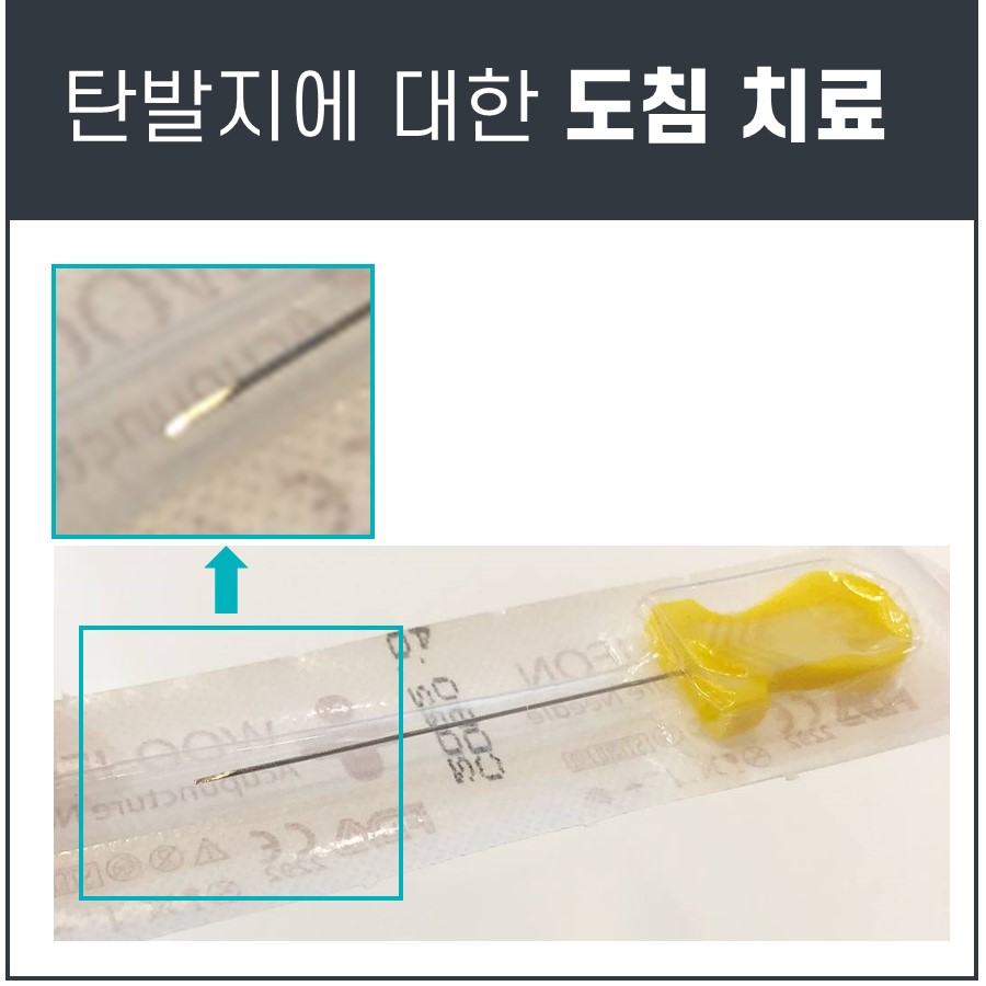 멸균 포장된 도침과 확대된 도침 끝 부분 — 초음파 유도하 약침 시술 | 서울 바로한의원