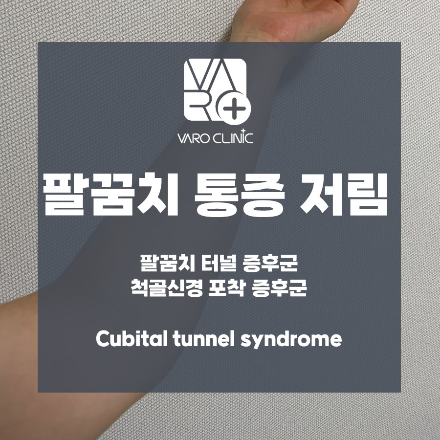 팔꿈치 통증과 저림, 팔꿈치 터널 증후군, 척골신경 포착 증후군에 대한 정보를 담은 안내 이미지 — 서울 바로한의원 초음파 약침·도침