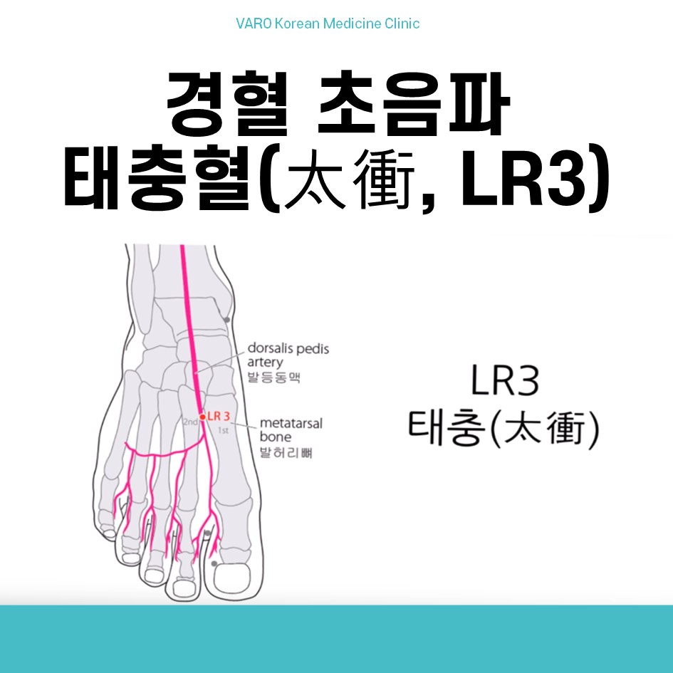발의 태충혈(LR3) 위치와 주변 혈관, 뼈를 나타내는 해부학적 도해 — 서울 바로한의원 초음파 약침·도침