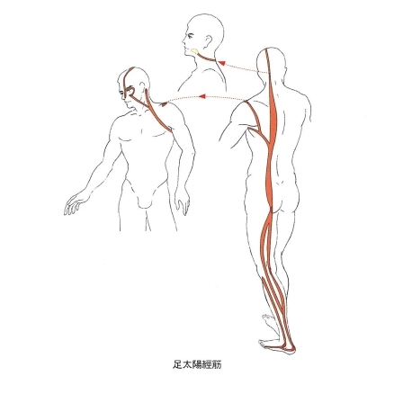 머리부터 아킬레스건까지 이어지는 족태양경근의 인체 경로를 나타낸 그림입니다 — 서울 바로한의원 초음파 약침·도침