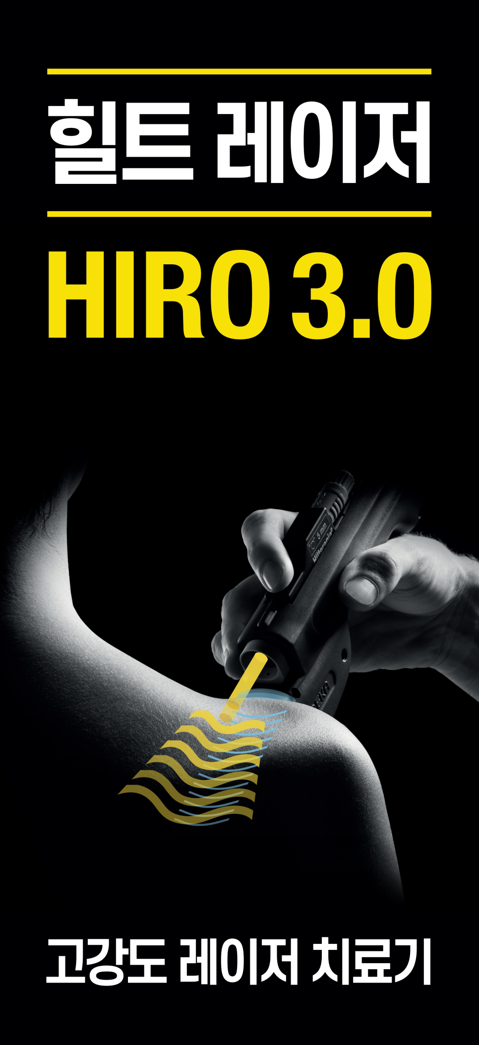 검은 배경에 한 손이 힐트 레이저 치료기 HIRO 3.0을 사용하여 어깨에 레이저를 조사하는 모습 — 서울 바로한의원 초음파 약침·도침
