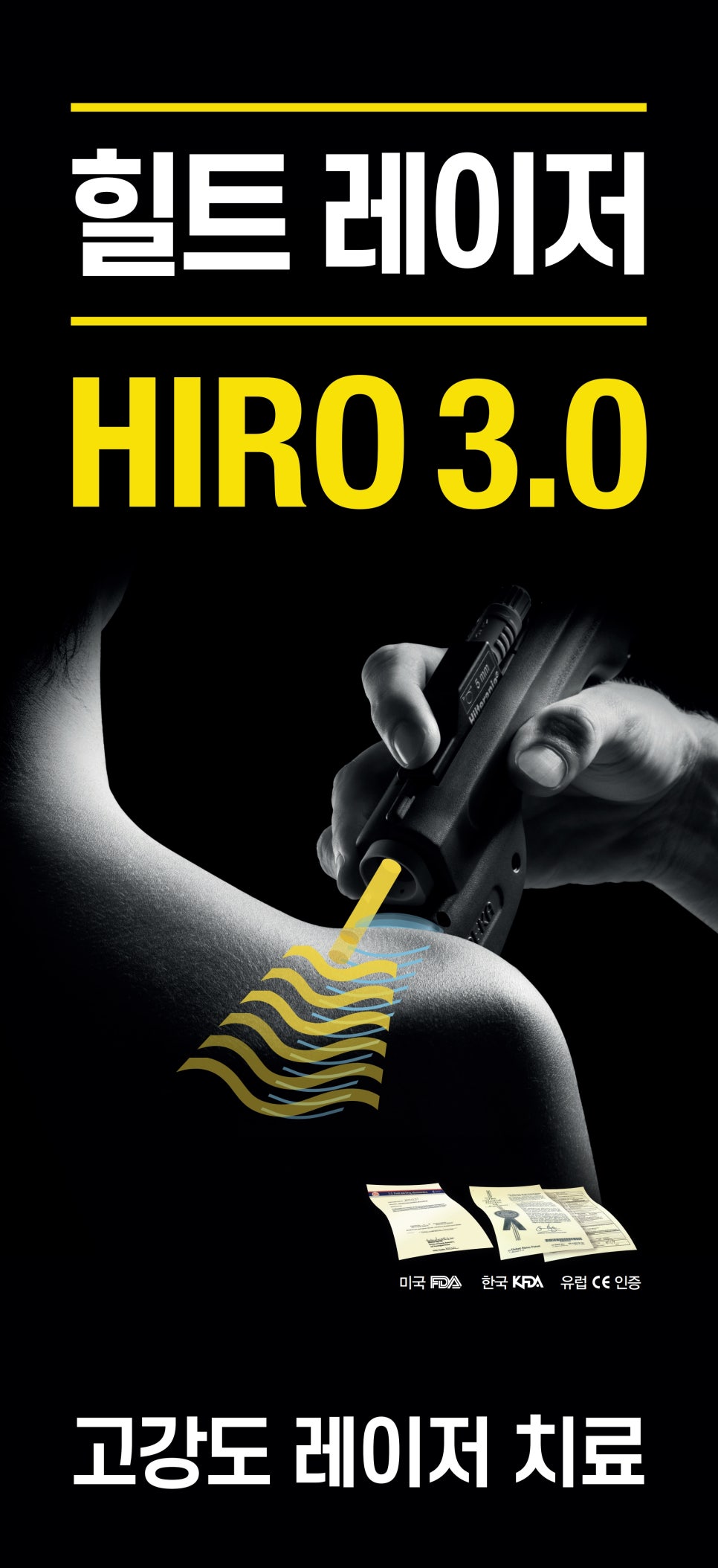 HIRO 3.0 레이저 치료 기기로 사람의 팔에 레이저를 조사하는 모습. 레이저가 피부에 닿는 부분을 물결 모양으로 표현했으며, 하단에 FDA, KFDA, CE 인증 문구가 있다 — 서울 바로한의원 초음파 약침·도침