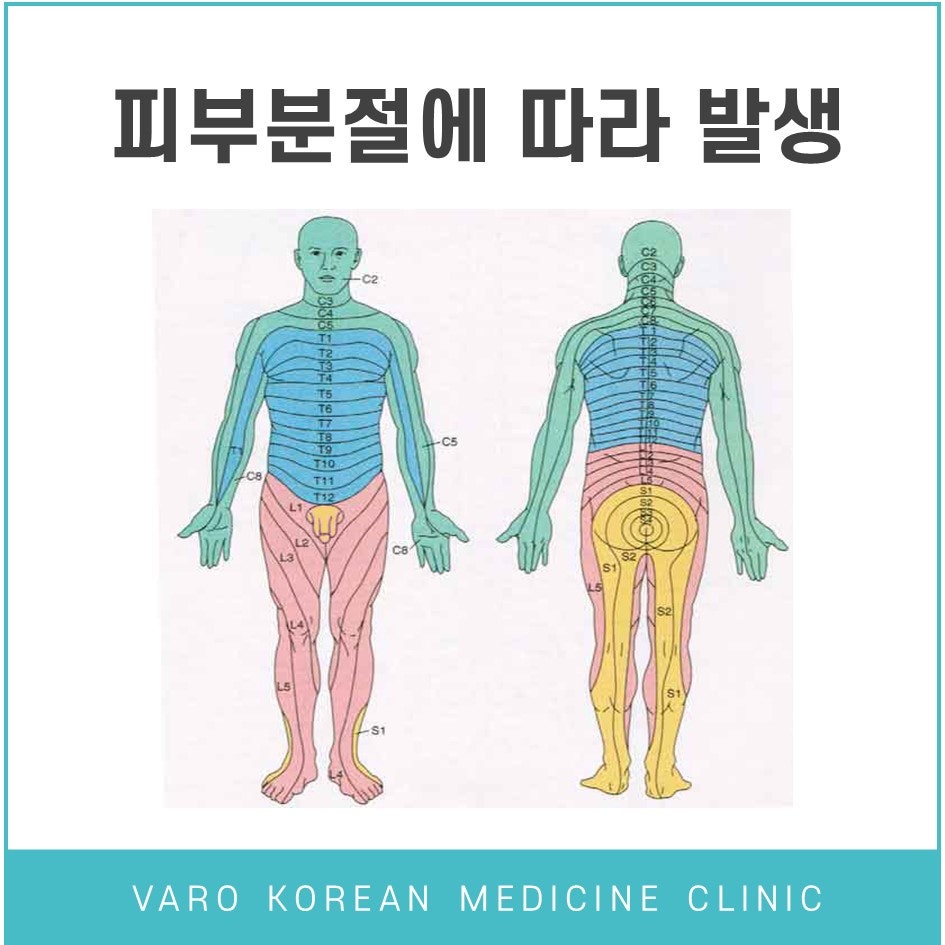 인체의 앞면과 뒷면 피부 분절을 색상으로 구분하여 표시한 그림 — 서울 바로한의원 초음파 약침·도침