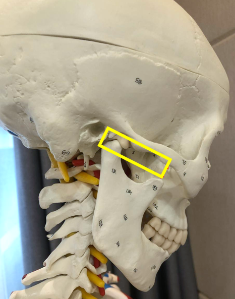 측면에서 본 인체 두개골 모형으로, 턱관절 부위가 노란색 사각형으로 표시되어 있다 — 서울 바로한의원 초음파 약침·도침