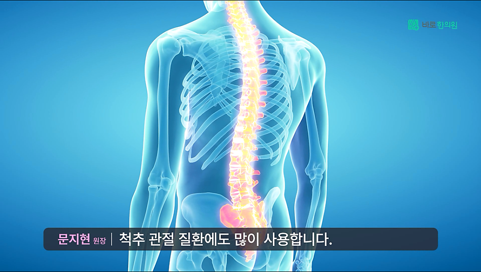 뒤에서 본 인체 척추와 골반 부위가 강조된 3D 해부학 이미지 — 서울 바로한의원 초음파 약침·도침