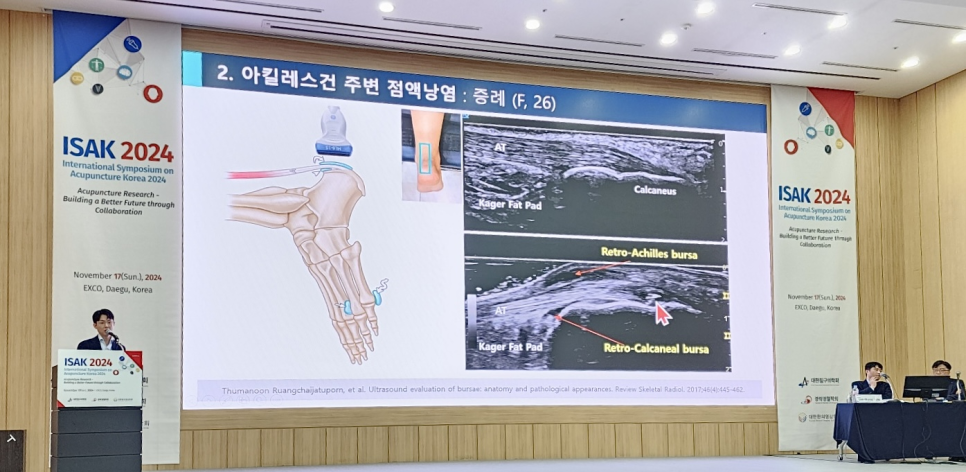ISAK 2024 국제학술대회에서 연사가 아킬레스건 주변 점액낭염 초음파 이미지와 해부학적 그림이 있는 발표 화면 앞에서 이야기하고 있다 — 대한한의영상학회 초음파 약침·도침 강의 | 서울 바로한의원