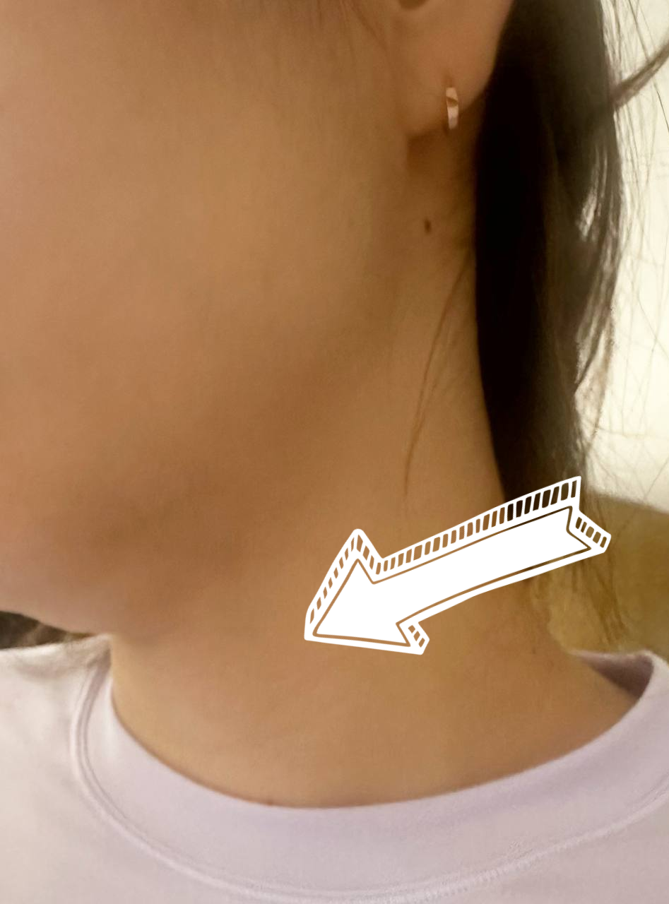 한 사람의 목과 어깨 부위를 측면에서 촬영한 사진으로, 흰색 화살표가 목 옆 부분을 가리키고 있습니다 — 서울 바로한의원 초음파 약침·도침