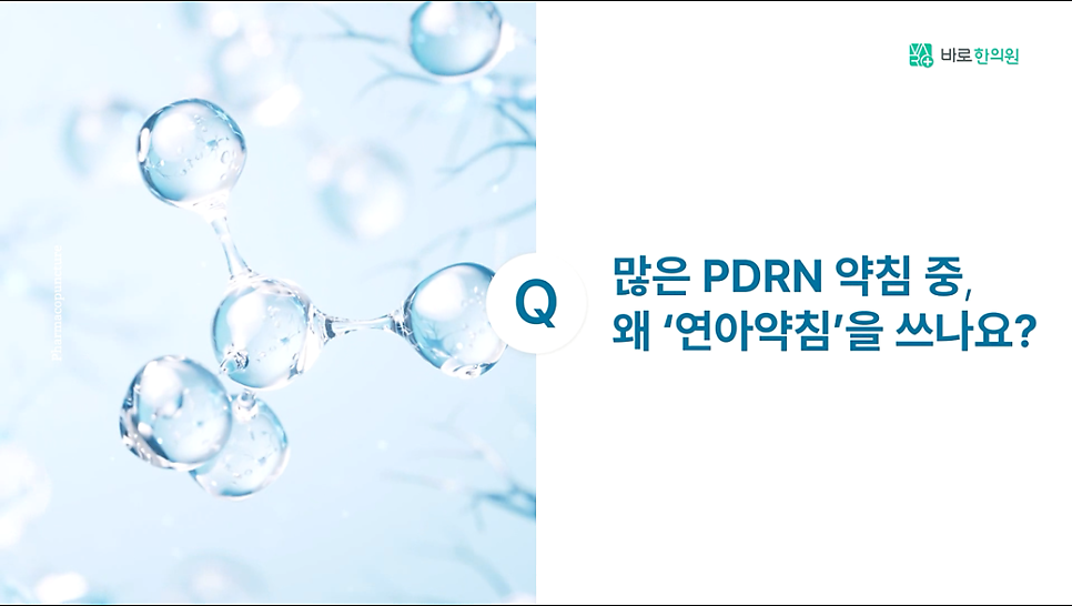 푸른 배경에 투명한 구슬 모양의 분자 구조와 '많은 PDRN 약침 중, 왜 연아약침을 쓰나요?'라는 질문 텍스트가 함께 있는 이미지 — 서울 바로한의원 초음파 약침·도침