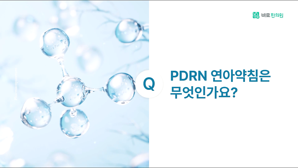 밝은 파란색 배경에 투명한 구형 분자 구조가 있고, 오른쪽에 'PDRN 연아약침은 무엇인가요?'라는 질문이 적혀 있습니다 — 서울 바로한의원 초음파 약침·도침