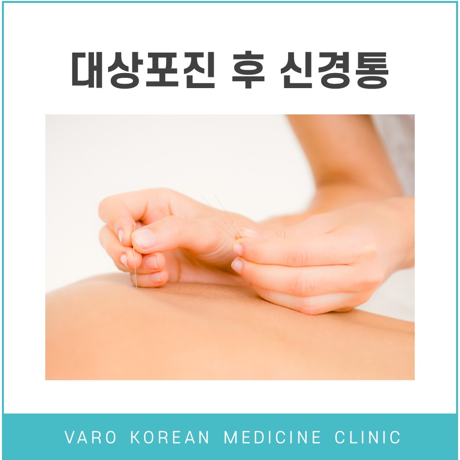 사람의 등에 침을 놓는 모습 — 서울 바로한의원 초음파 약침·도침
